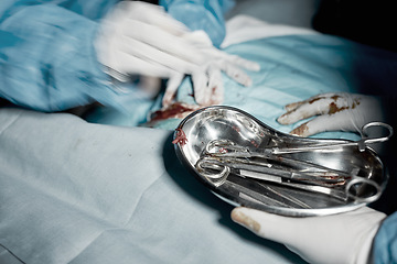 Image showing Operation, blood and motion blur with doctors hands in a hospital for medical or life saving surgery. Healthcare, emergency or teamwork between a doctor and medicine team in a clinic ER theater