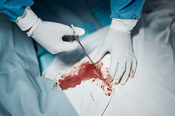 Image showing Surgery cut, blood and surgeon doctor hands with medical scissors for hospital and clinic emergency. Health service, injury help and wellness care of a healthcare worker working on patient with tools