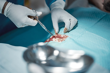 Image showing Surgeon hands, blood and doctor in surgery with medical scissors for hospital and clinic emergency. Health service, doctors and wellness care of a healthcare worker working on a patient with tools
