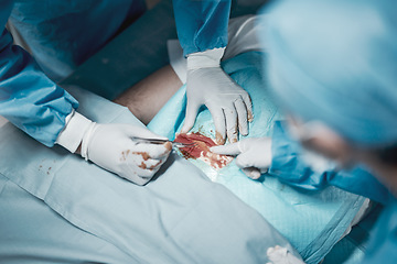 Image showing Surgery cut, nursing and doctor hands with medical surgeon scalpel for hospital and clinic emergency. Health service, doctors above and wellness of a healthcare worker working on a patient with blood