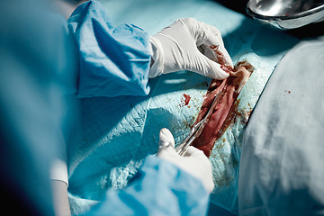 Image showing Surgery incision, blood and doctor hands zoom with medical surgeon scissors for hospital emergency. Health service clinic and wellness care of a healthcare worker working on a patient with tools