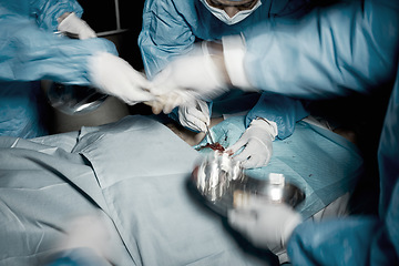 Image showing Hands, motion blur and surgery with doctors in a hospital emergency room for a life saving operation. Nurse, teamwork and medical with a doctor and team working in a clinic to save a critical patient