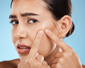 Image showing Woman, face and pop pimple with acne, anxiety and stress, beauty and skincare isolated on blue background. Skin problem, facial zoom and cosmetics in portrait, dermatology and cosmetic care in studio