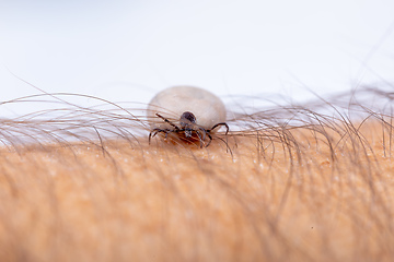 Image showing Tick on human hand