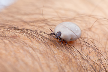 Image showing Tick on human hand