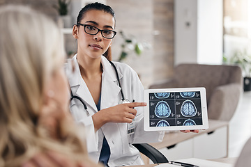 Image showing Brain, woman and doctor pointing at tablet, mri scan or xray diagnosis for cancer. Healthcare, advice and neurology patient in doctors office, help consulting on health problem for hospital treatment