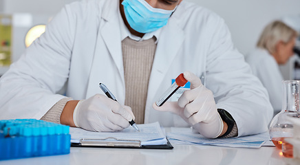 Image showing Science, writing and man in laboratory with blood sample for dna results, medical report and research. Biotechnology, health and scientist write notes for data analytics, analysis and investigation