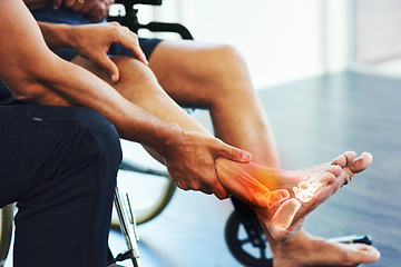 Image showing Rehabilitation, physiotherapist and help a patient with foot injury, pain and muscle tension recovery. Physiotherapy, male or doctor assist with strain, movement or wellness with person in wheelchair