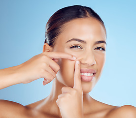 Image showing Portrait, pimple and woman in studio for acne, treatment and cosmetic skincare on blue background. Blackhead, spot and face of girl model with facial, breakout or dermatology problem while isolated