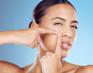 Image showing Pimple, portrait and woman in studio for acne, skincare and cosmetic treatment on blue background. Blackhead, spot and face of girl model with facial, breakout or dermatology problem while isolated
