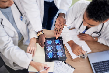 Image showing Tablet screen, brain and doctors in neurology research, internship training and teamwork for healthcare solution. Assessment, cancer analysis and xray of medical students or professional people above