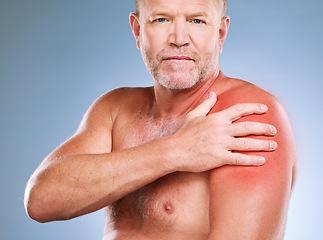 Image showing Sunburn, skincare and portrait of a man with red skin color and burn texture in studio. Isolated, blue background and male model looking for wellness, health and soothing solution for body problem