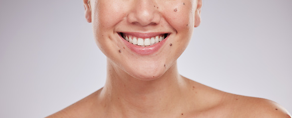 Image showing Face smile, dental and teeth of woman in studio isolated on a gray background. Skincare makeup, cosmetics and lips, mouth and oral hygiene of happy female model with veneers, invisalign and wellness.