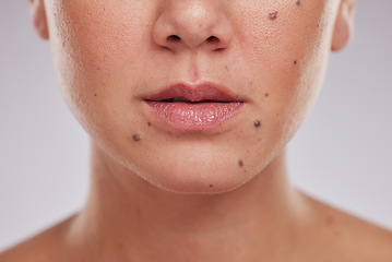 Image showing Lips, mouth and woman, face and beauty with closeup, skincare and lip filler with collagen on studio background. Skin, dermatology and cosmetic care with wellness, natural cosmetics and cosmetology