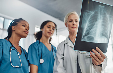 Image showing Xray, doctor and nurses, team and medicine with analysis of lung scan and cardiology medical group. Surgeon, collaboration and results with healthcare, focus with health and prepare for surgery