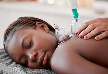 Image showing Black woman, hands and cupping therapy on back in spa for pain relief, blood flow and relaxation at resort. Hand of therapist with glass vacuum cups on African American female in deep tissue massage