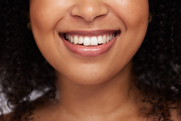 Image showing Black woman, teeth and smile for dental care, whitening or oral and mouth treatment. Closeup of happy African American female model smiling for dentist results, healthcare or clean tooth hygiene