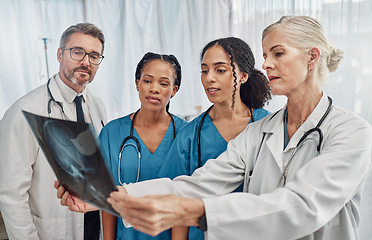 Image showing Xray, doctors and nurses, group and health with analysis of brain scan and neurology medical team. Surgeon, collaboration and results with healthcare, focus with radiology and prepare for surgery