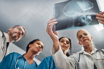 Image showing Xray, doctors and nurses, team and healthcare, analysis of skull scan and neurology medical group. Surgeon, collaboration and results with health, head trauma with medicine and prepare for surgery