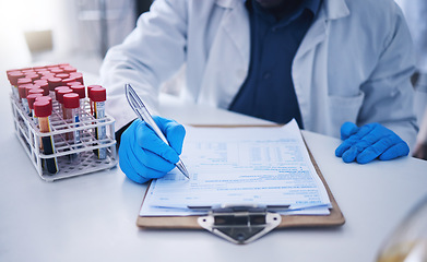 Image showing Blood test, science documents and hands in laboratory for healthcare results, research or review development. Scientist, medicine and writing medical results of dna investigation, paperwork or report