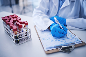 Image showing Blood test, medicine documents and hands in laboratory for healthcare planning, science review or checklist. Scientist, report and writing medical results of dna investigation, paperwork and research