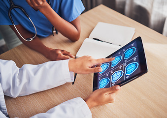 Image showing Doctor, tablet and brain xray, neurology and digital test results, people and healthcare team in hospital. MRI, technology and screen in hands, cancer and radiology, anatomy and health assessment