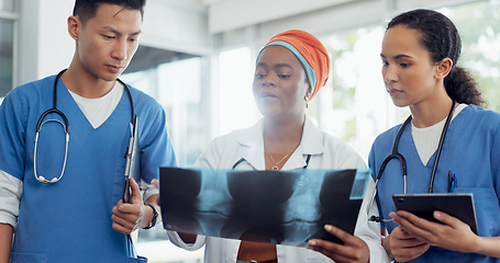 Image showing Doctor, x ray and collaboration with a woman surgeon and team talking about diagnosis in a hospital. Medical, teamwork and healthcare with a female medicine professional training interns in a clinic