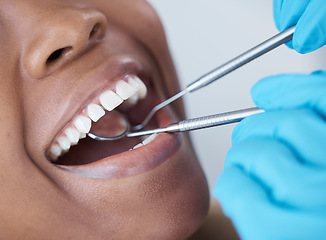 Image showing Checkup, mouth and woman at the dentist for dental care, healthcare and search for cavities. Mirror, healthy and doctor looking at the teeth of a patient for treatment, oral hygiene and surgery