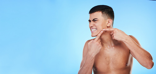 Image showing Face, man and hands press pimple for acne or skin, mockup space and dermatology problem for skincare in studio on blue background. Self care, person scratch and pop blackhead for facial cleaning