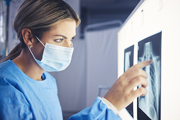 Image showing Healthcare, woman and doctor analyzing xray for medical diagnosis on a screen in the hospital. Professional, career and female radiologist checking a spine, lung and chest scan in a medicare clinic.