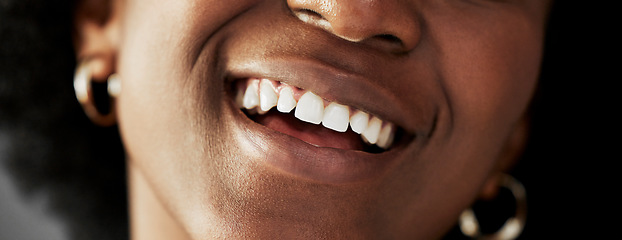 Image showing Dental, beauty and teeth with closeup of person for medical, cosmetics and oral hygiene. Health, orthodontics and smile with mouth of black woman for self care, gum and whitening treatment on banner