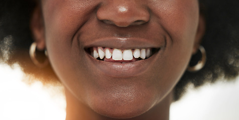 Image showing Dental, smile and teeth with closeup of person for medical, cosmetics and oral hygiene. Healthcare, orthodontics and beauty with mouth of black woman for self care, gum and whitening treatment