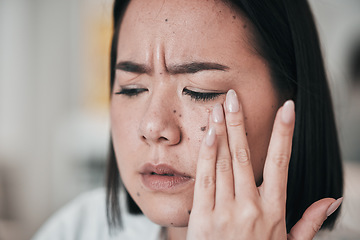 Image showing Woman, scientist and headache from stress, anxiety or problem in laboratory working with pharmaceutical research. Tired, fatigue and professional burnout in science, lab or person with migraine pain