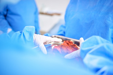 Image showing Organ transplant, hands and doctor surgery, medical support or teamwork on liver, healing accident injury or anatomy. Emergency, lung blood and closeup surgeon collaboration in ICU healthcare service