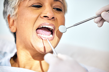 Image showing Senior woman, mouth and dentist check teeth, metal tools and hands with healthcare, toothache and dental surgery. Cleaning, wellness and health with oral care procedure, equipment and help with trust