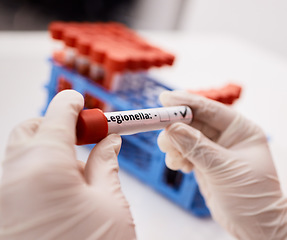 Image showing Legionella, blood or hands of scientist with vaccine in science laboratory with dna and rna research. Test results, analysis closeup or person working with liquid for chemistry or breakthrough cure