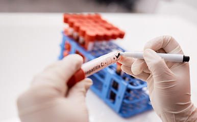 Image showing Label, scientist or hands writing on blood test tube, DNA or science experiment in laboratory. Closeup, hepatitis or person with study sample or research for biology innovation or medical results