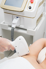 Image showing Laser epilation of armpits