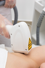 Image showing Laser epilation of armpits