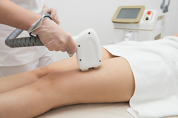 Image showing Laser epilation of legs