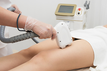 Image showing Laser epilation of legs