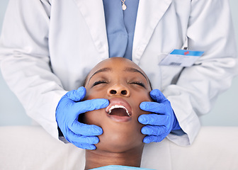 Image showing Dentist check teeth, patient and people at clinic, consultation and mouth with dental health and medical treatment. Oral hygiene, healthcare and surgery, orthodontics and tooth decay with hands