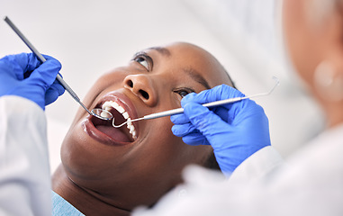 Image showing Dentist, patient and women at clinic, tools in consultation and check mouth for dental health and medical treatment. Oral hygiene, healthcare and surgery, orthodontics and tooth decay with excavator