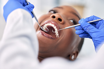 Image showing Dentist, patient and women in consultation, tools and check mouth for dental health and medical treatment. Oral hygiene, healthcare and orthodontics, tooth decay and clean for cavity and excavator