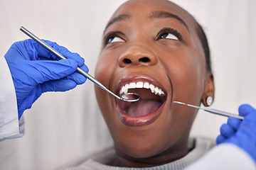 Image showing Dentist hands, patient mouth and tools, check teeth for dental health and medical treatment. Oral hygiene, healthcare and orthodontics, black woman with tooth decay and clean for cavity and excavator