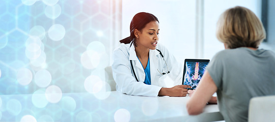 Image showing Doctor, patient and pointing on tablet for diagnosis on banner for mock up, bokeh and overlay for healthcare. Space, medicine or technology for results on x-ray for treatment, clinic or hospital