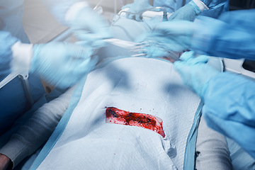 Image showing Hands, blood and operation with a team of doctors at work during surgery with equipment or a tool in a hospital. Doctor, nurse and collaboration with a medicine professional group saving a life
