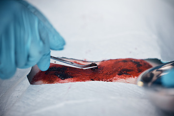 Image showing Doctors, nurses or surgery hands on cut patient in hospital emergency room for stomach ulcer, heart attack or burst appendix. Zoom, healthcare workers or surgical operation and steel metal equipment