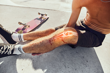 Image showing Skateboard injury, pain and legs of man after fitness, exercise or sports workout in skatepark. Medical emergency, training accident problem and athlete skater anatomy of broken knee bone with blood