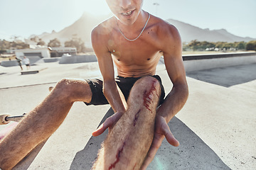 Image showing Skater, knee pain and man with blood on injury after a skateboard accident in sports skate park in summer. First aid, emergency and person with leg wound or bruise for falling in training or exercise